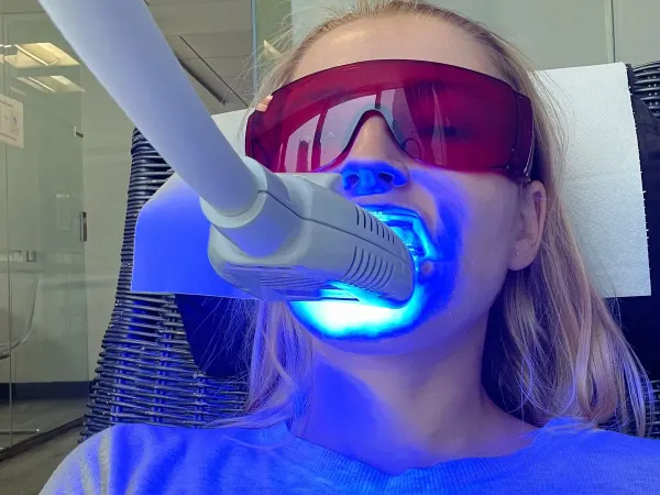Zoom Whitening Cost in Huntington Beach | HB Dentist at HB Dentist Huntington Beach