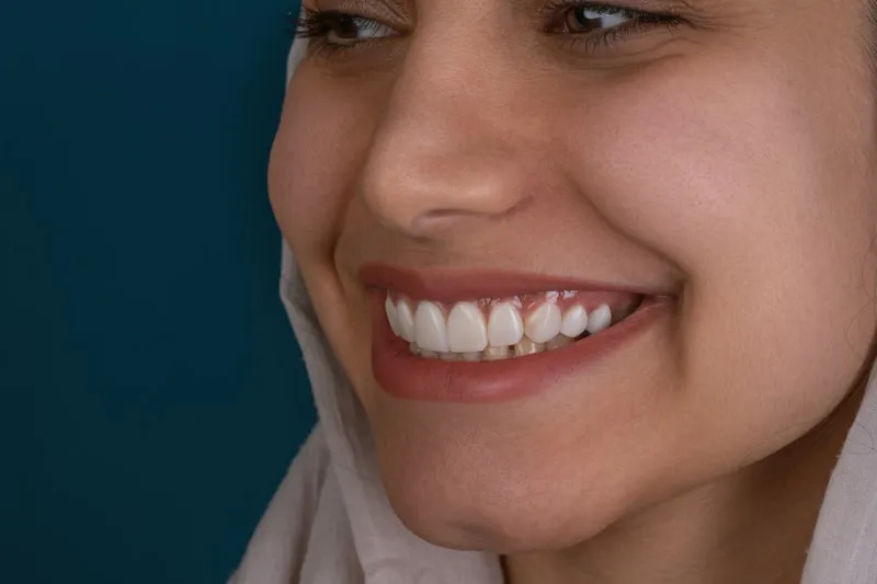 Woman with a bright white smile showing the results of professional teeth whitening