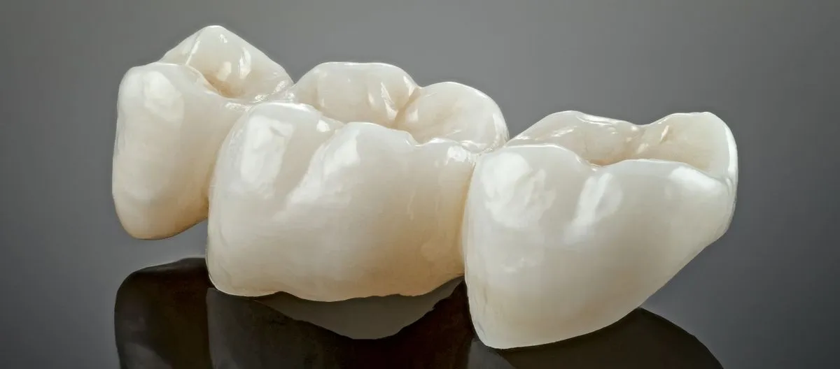 Crowns & Bridges at HB Dentist Huntington Beach