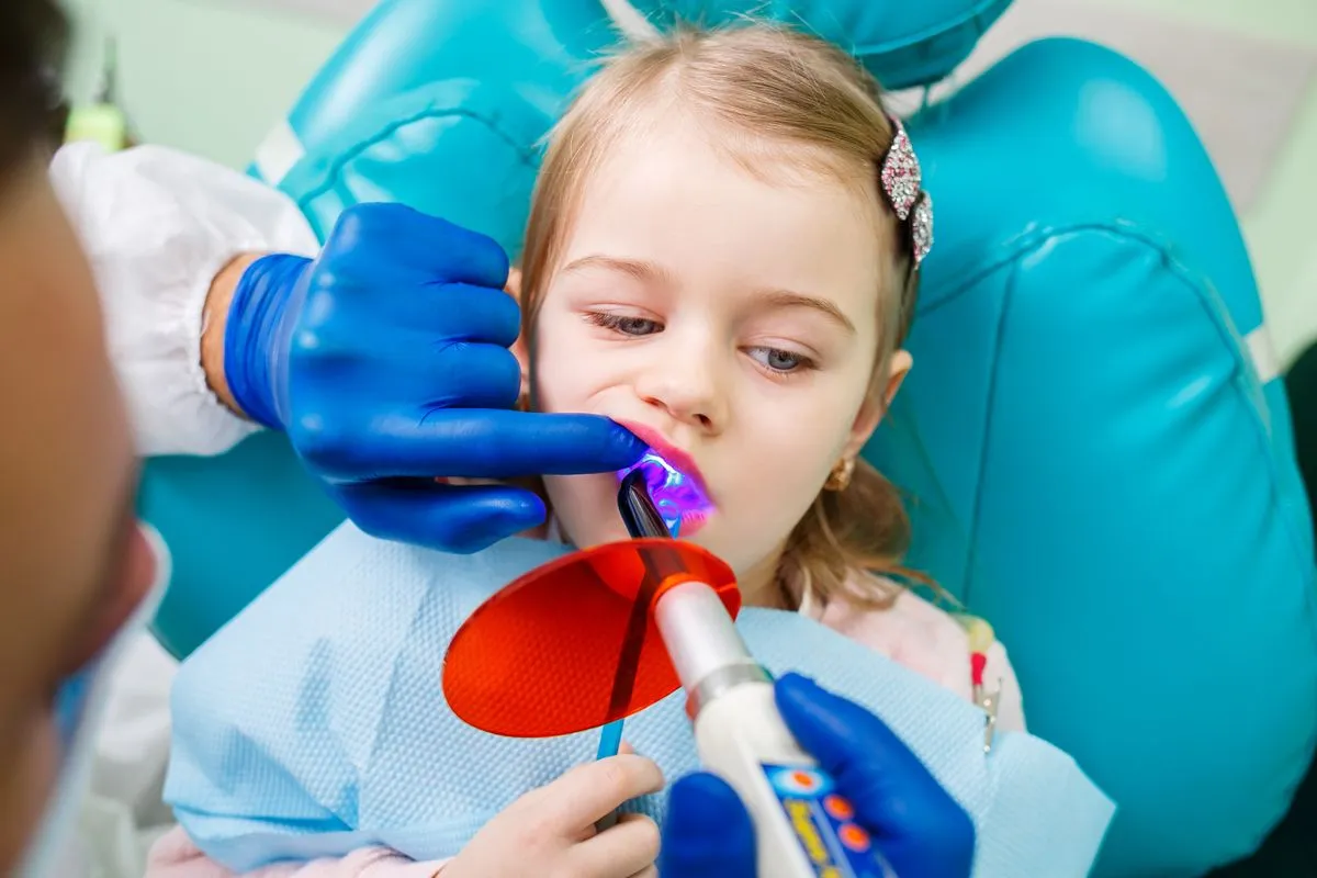 Dental Sealants at HB Dentist Huntington Beach