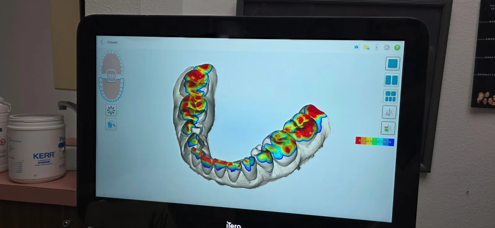 Digital smile design displayed at HB Dentist in Huntington Beach, California