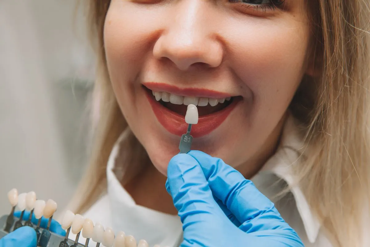 Beautiful porcelain veneers creating a flawless, natural-looking smile